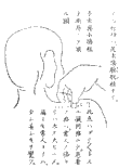 鍼術秘要図05