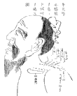 鍼術秘要図06