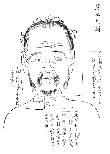 鍼術秘要図11