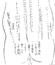 鍼術秘要図12
