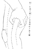 鍼術秘要図14