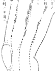 鍼術秘要図15