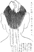 鍼術秘要図18