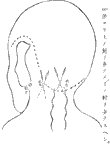 鍼術秘要図19