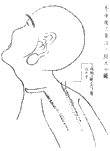 鍼術秘要図21