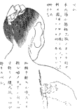鍼術秘要図24