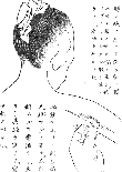 鍼術秘要図25