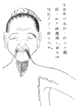 鍼術秘要図26