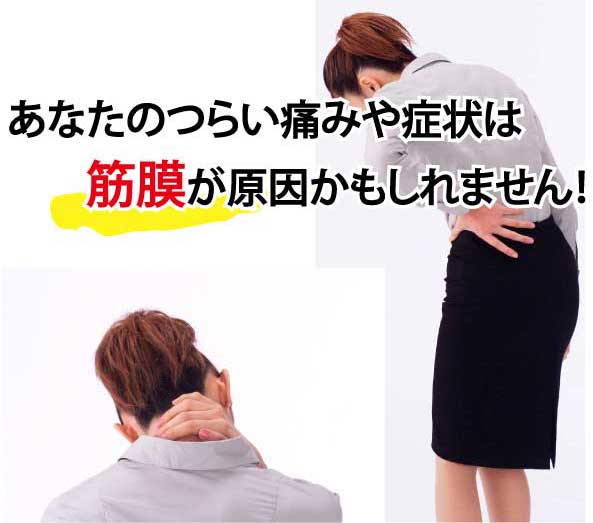 腰の痛みは筋膜が原因