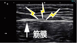 筋膜の構造